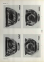 thumbnail of bitstream