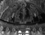 thumbnail of bitstream
